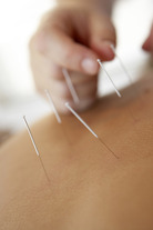 Acupuncture For Cancer