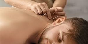 acupuncture in the villages