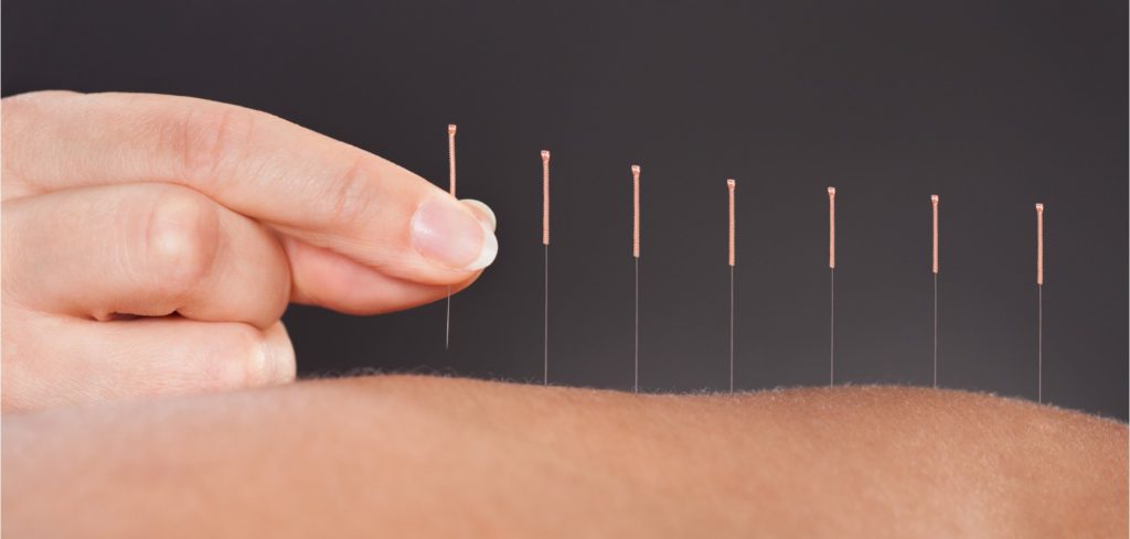 acupuncture for cancer