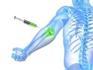 Ozone Injections For Joint Pain