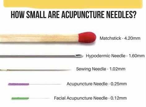 Acupuncture needles size? / Acupuncture in The Villages