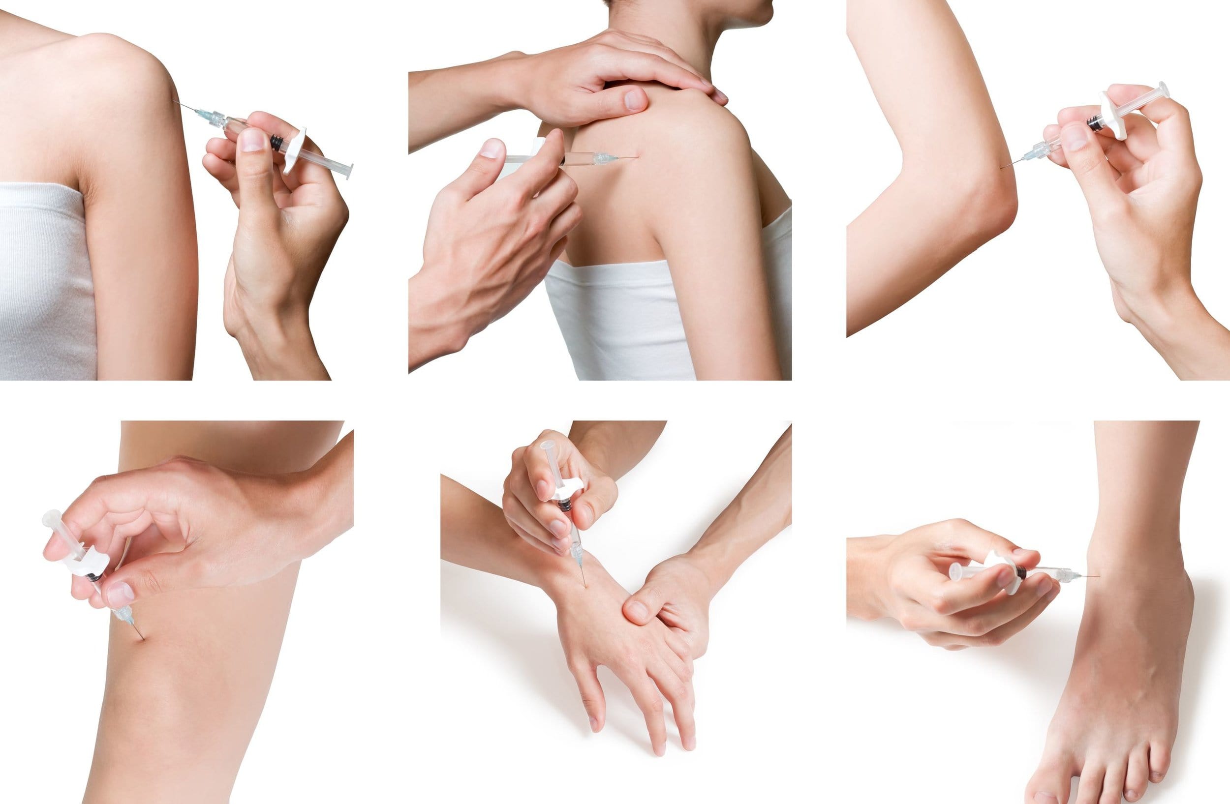 Prolozone Therapy: Safe and Effective Shoulder Injury Treatment