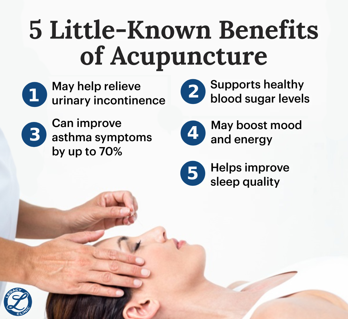 How Acupuncture Helps You Relax