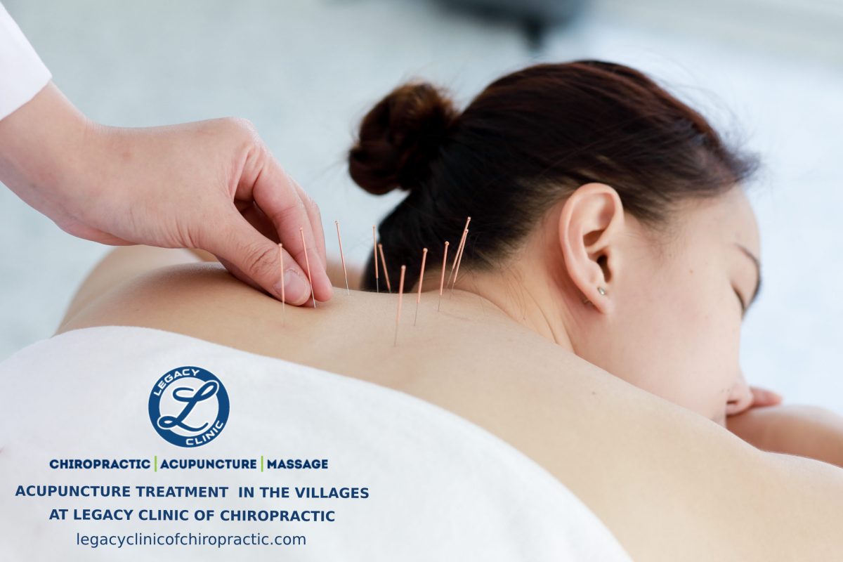 Acupuncture in the villages
