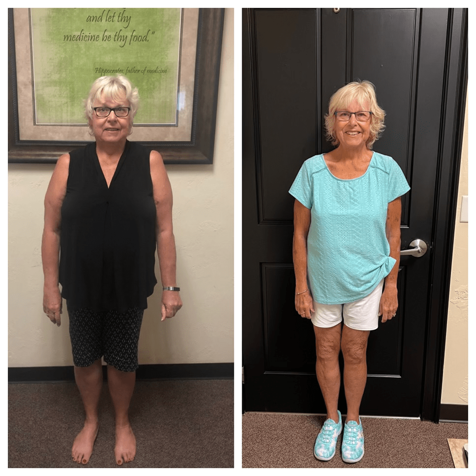 Weight Loss Results in the Villages