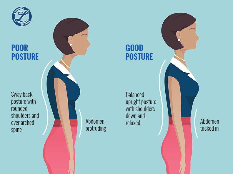 Best Posture Exercises