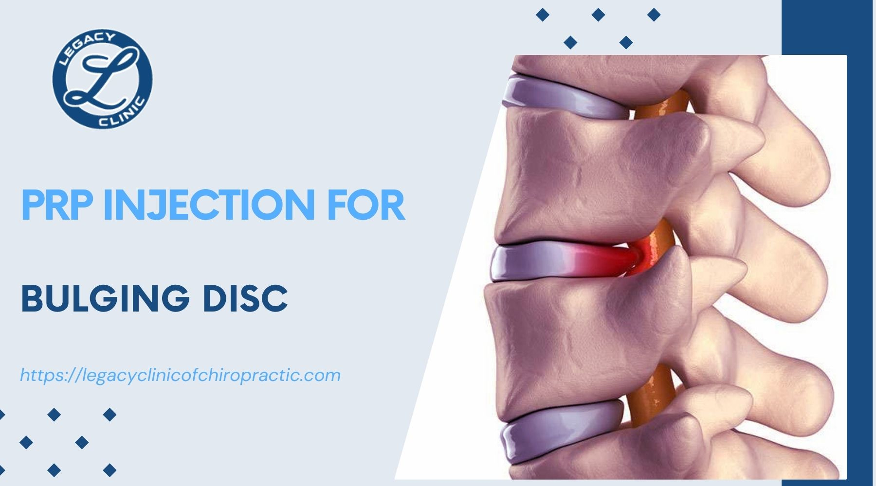 prp injection for bulging disc